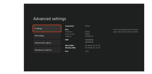 How to find your Xbox One's IP address 1