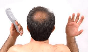 Reasons for hair loss